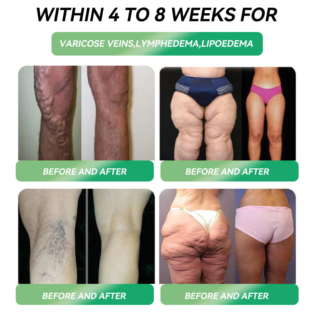 👨‍⚕️𝐎𝐟𝐟𝐢𝐜𝐢𝐚𝐥 Ireland 𝐂𝐞𝐫𝐭𝐢𝐟𝐢𝐞𝐝🥇𝐅𝐥𝐚𝐠𝐬𝐡𝐢𝐩 𝐒𝐭𝐨𝐫𝐞 𝐃𝐢𝐫𝐞𝐜𝐭 𝐒𝐚𝐥𝐞𝐬| 𝘓𝘌𝘙𝘊𝘌𝘈® 𝐆𝗟𝐏-𝟏 𝑴𝒆𝒕𝒂𝒃𝒐𝒍𝒊𝒄 𝑩𝒂𝒍𝒂𝒏𝒄𝒆 𝑶𝒓𝒂𝒍 𝑨𝒎𝒑𝒐𝒖𝒍𝒆𝒔🌿: 𝐒𝐮𝐢𝐭𝐚𝐛𝐥𝐞 𝐟𝐨𝐫 𝐨𝐛𝐞𝐬𝐢𝐭𝐲, 𝐜𝐚𝐫𝐝𝐢𝐨𝐯𝐚𝐬𝐜𝐮𝐥𝐚𝐫 𝐝𝐢𝐬𝐞𝐚𝐬𝐞𝐬, 𝐝𝐢𝐚𝐛𝐞𝐭𝐞𝐬, 𝐬𝐥𝐞𝐞𝐩 𝐚𝐩𝐧𝐞𝐚 𝐬𝐲𝐧𝐝𝐫𝐨𝐦𝐞, 𝐣𝐨𝐢𝐧𝐭 𝐢𝐬𝐬𝐮𝐞𝐬, 𝐚𝐧𝐝 𝐦𝐨𝐫𝐞 🔥🔥